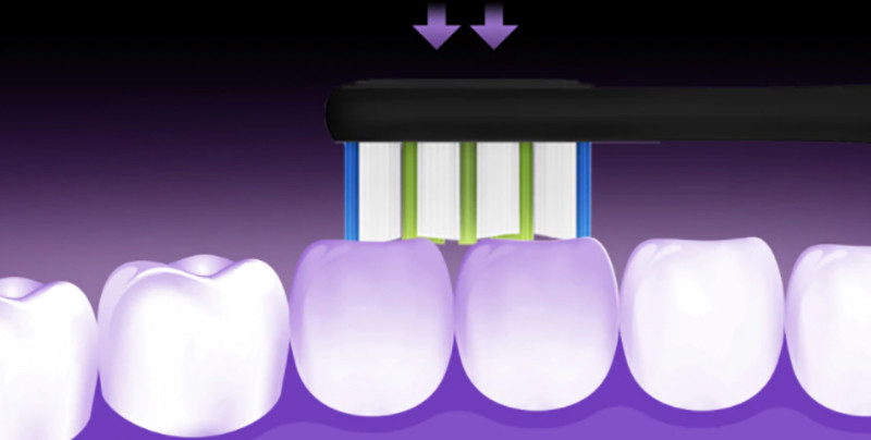 Avis Oclean X Pro Brosse à Dents Sonique Intelligente Brosses électriques Soins Buccaux