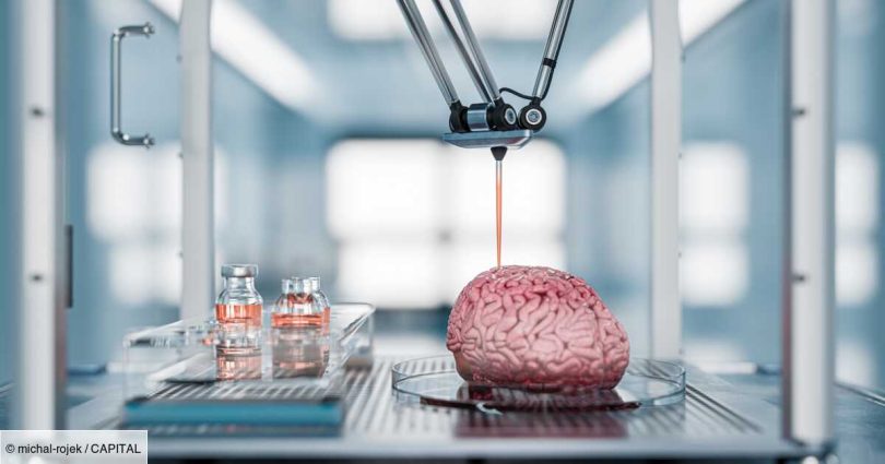 Implants Cérébraux Révolutionnaires en Développement par des Scientifiques pour Traiter le Parkinson