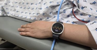 Gros plan sur le poignet d'un patient portant une Samsung Galaxy Watch 6 au bracelet noir en tissu, affichant une courbe de variabilité cardiaque et la valeur 59% lors d'un test médical induit. La montre repose sur la table d'examen grise à côté d'un tube d'eau bleu et sous la blouse d'hôpital à motifs. L'algorithme PPG de la montre analyse les données cardiaques pour prédire les évanouissements 5 minutes à l'avance.